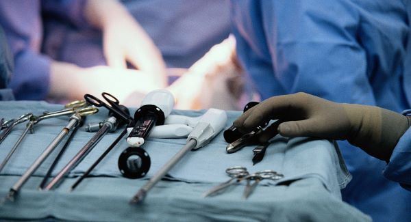 Questions about number of surgeries perf